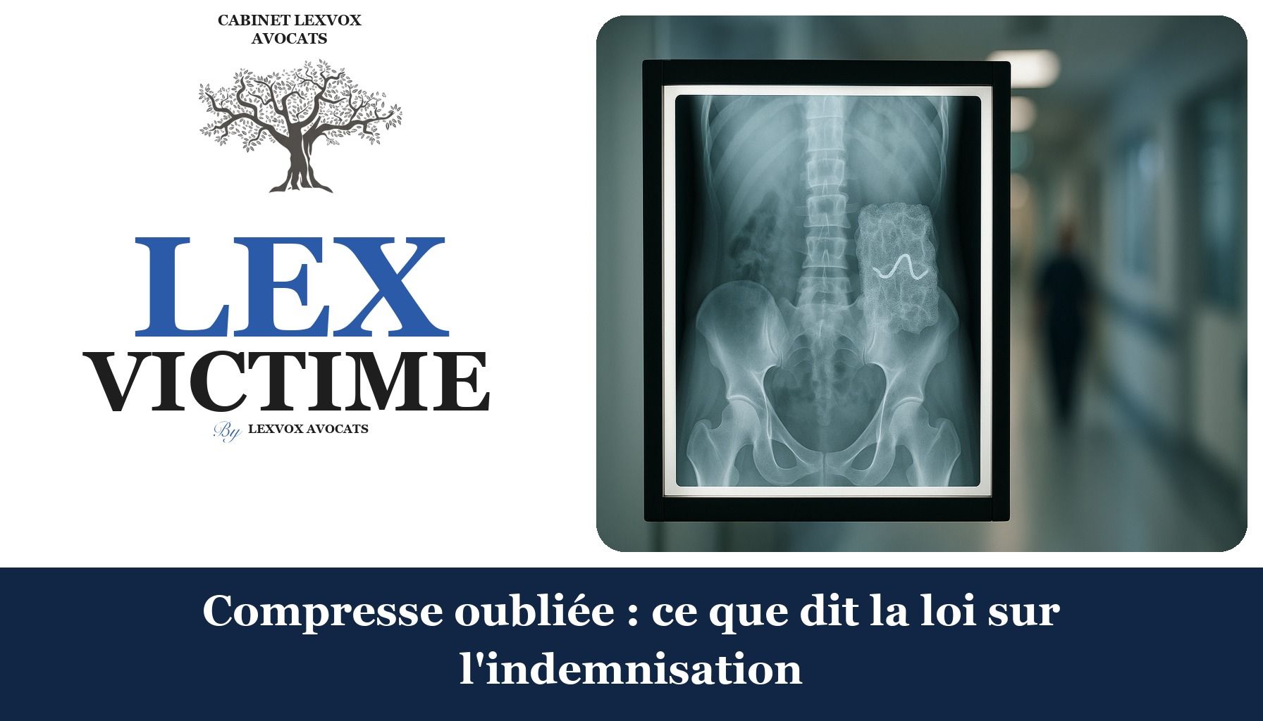 Compresse oubliée : ce que dit la loi sur l'indemnisation