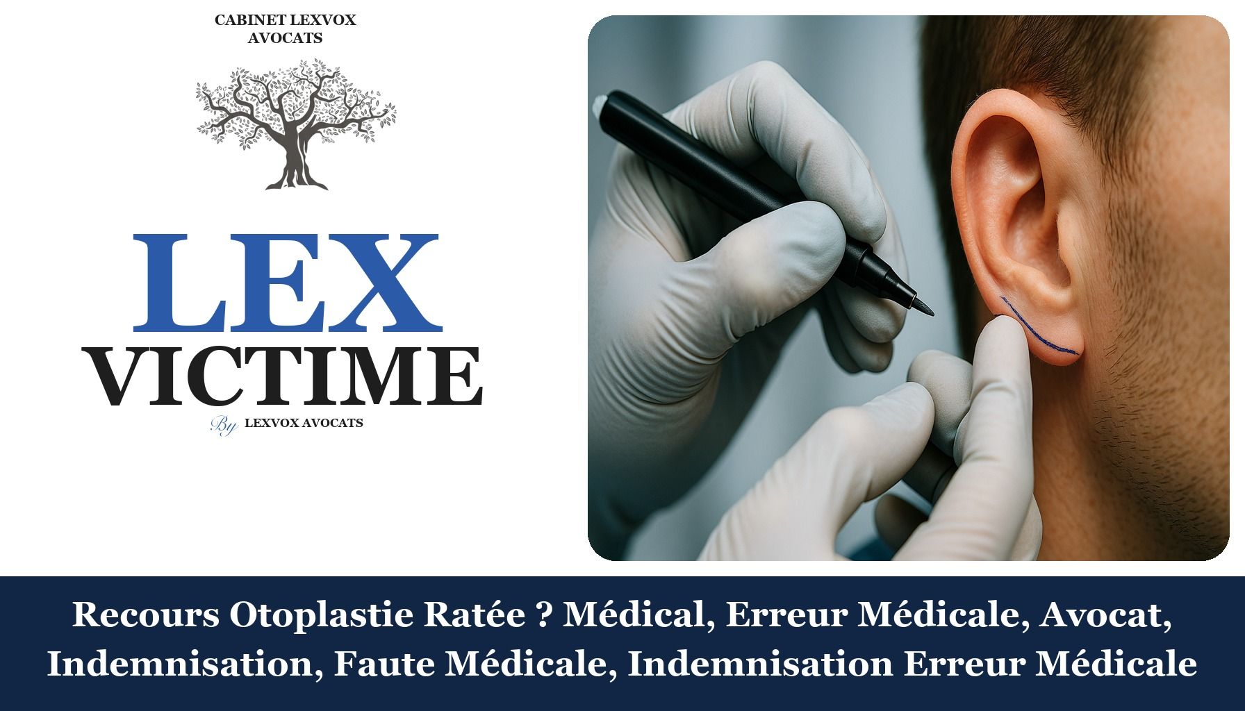 Recours Otoplastie Ratée ? Médical, Erreur Médicale, Avocat, Indemnisation, Faute Médicale, Indemnisation Erreur Médicale