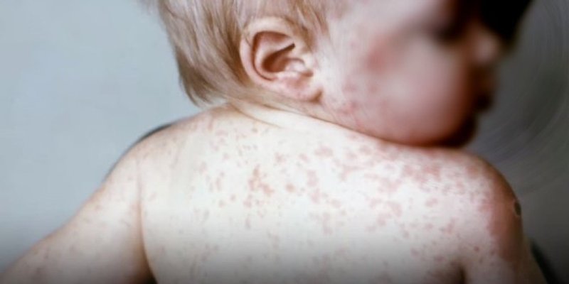 Ospice jenjavaju u Europi