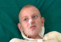 MEDICINSKO ČUDO Roko (15) je preživio strujni udar od 35.000 volti. Sad se vratio kući