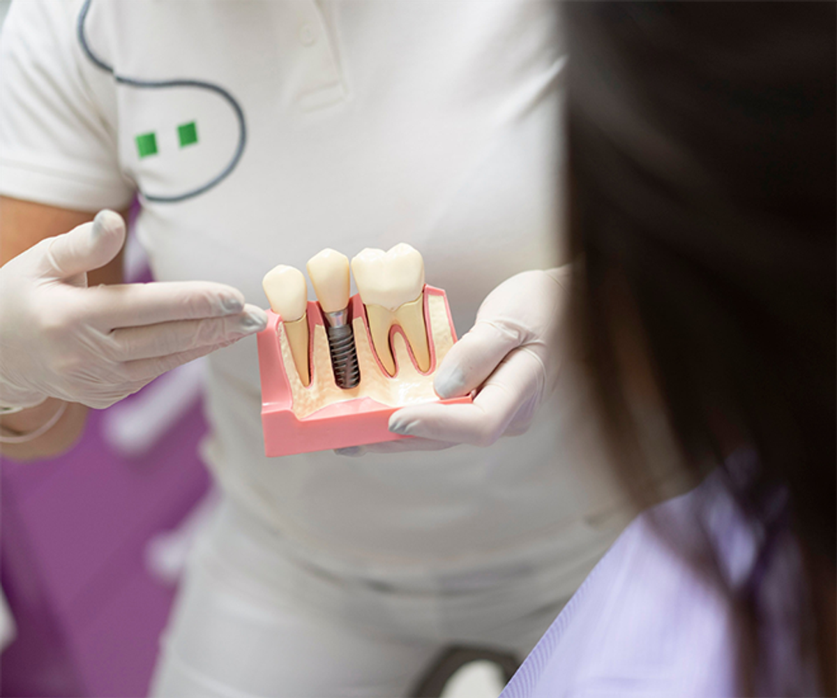 Bezubost: Kako je spriječiti i vratiti osmijeh na lice?