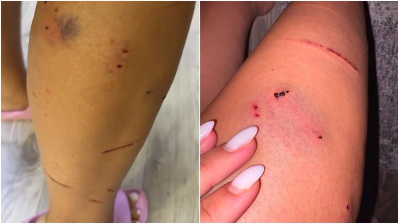VIDEO Ulična mačka napala curu u Trogiru, puna je rana i ogrebotina: 'Ovo još nisam vidjela, očito je bolesna'