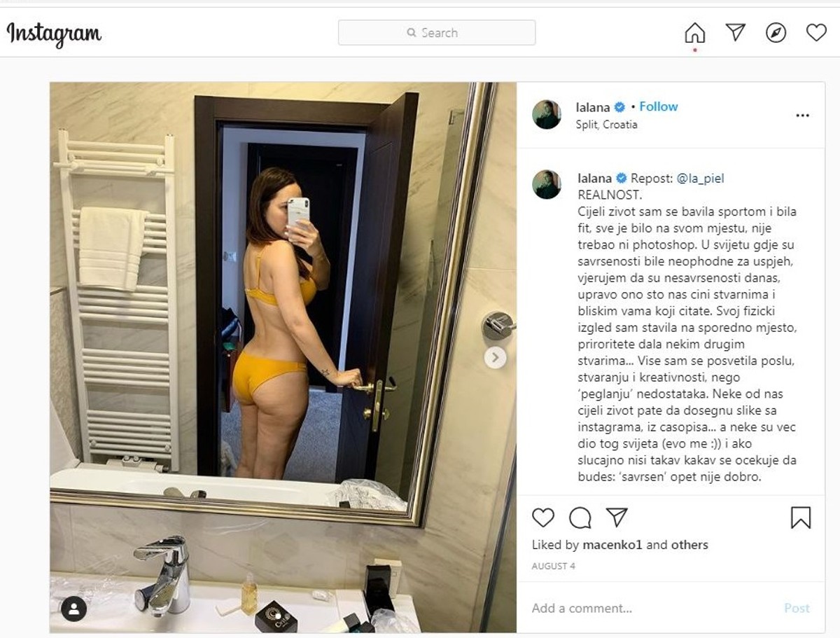 ODVAŽNO Lana nakon celulita objavila fotku prištavog lica