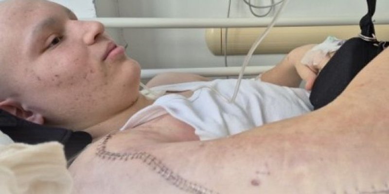 U Naklicama humanitarni balotaški turnir za 19-godišnjeg Bepa iz Podstrane