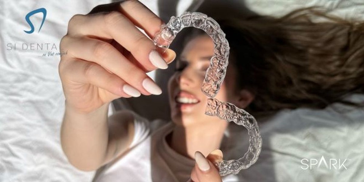 U SI Dentalu od sada dostupan Spark Clear Aligner System 