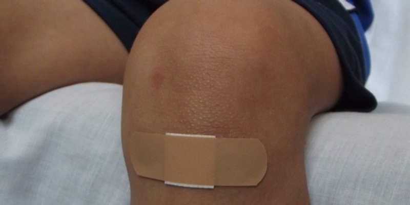 KUĆNA MEDICINA Prirodni lijekovi za rane