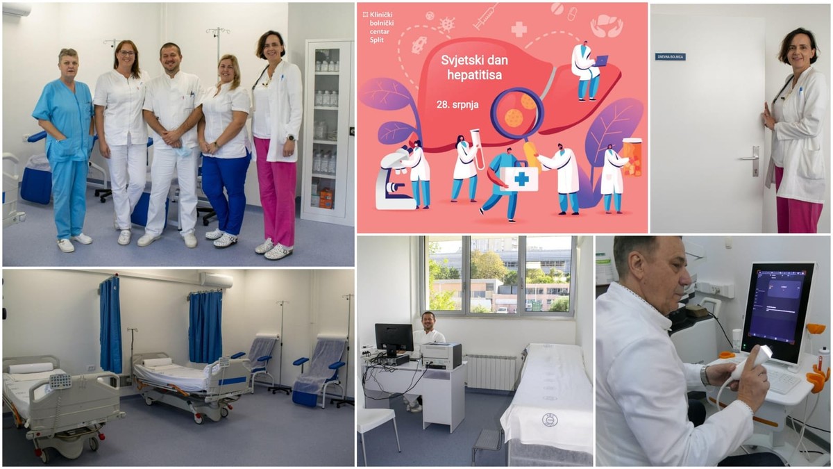 UPOZORENJE IZ KBC-a SPLIT 'Zbog migracija i nedovoljne procijepljenosti virusni hepatitisi i dalje su značajan izazov'