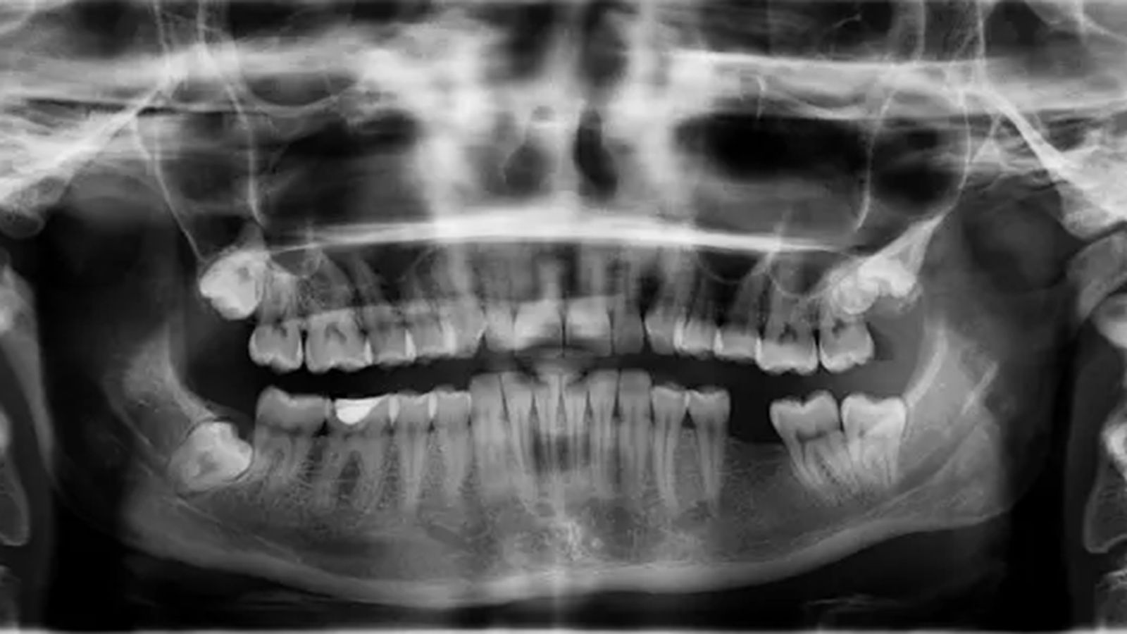 U Splitu će se održati stručni skup 'Oralno zdravlje za opće zdravlje'