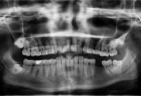 U Splitu će se održati stručni skup 'Oralno zdravlje za opće zdravlje'