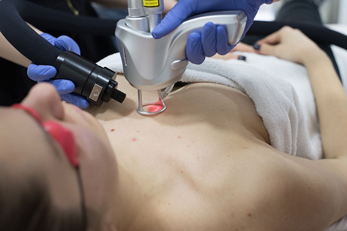 Kako se riješiti hiperpigmentacija na licu? 