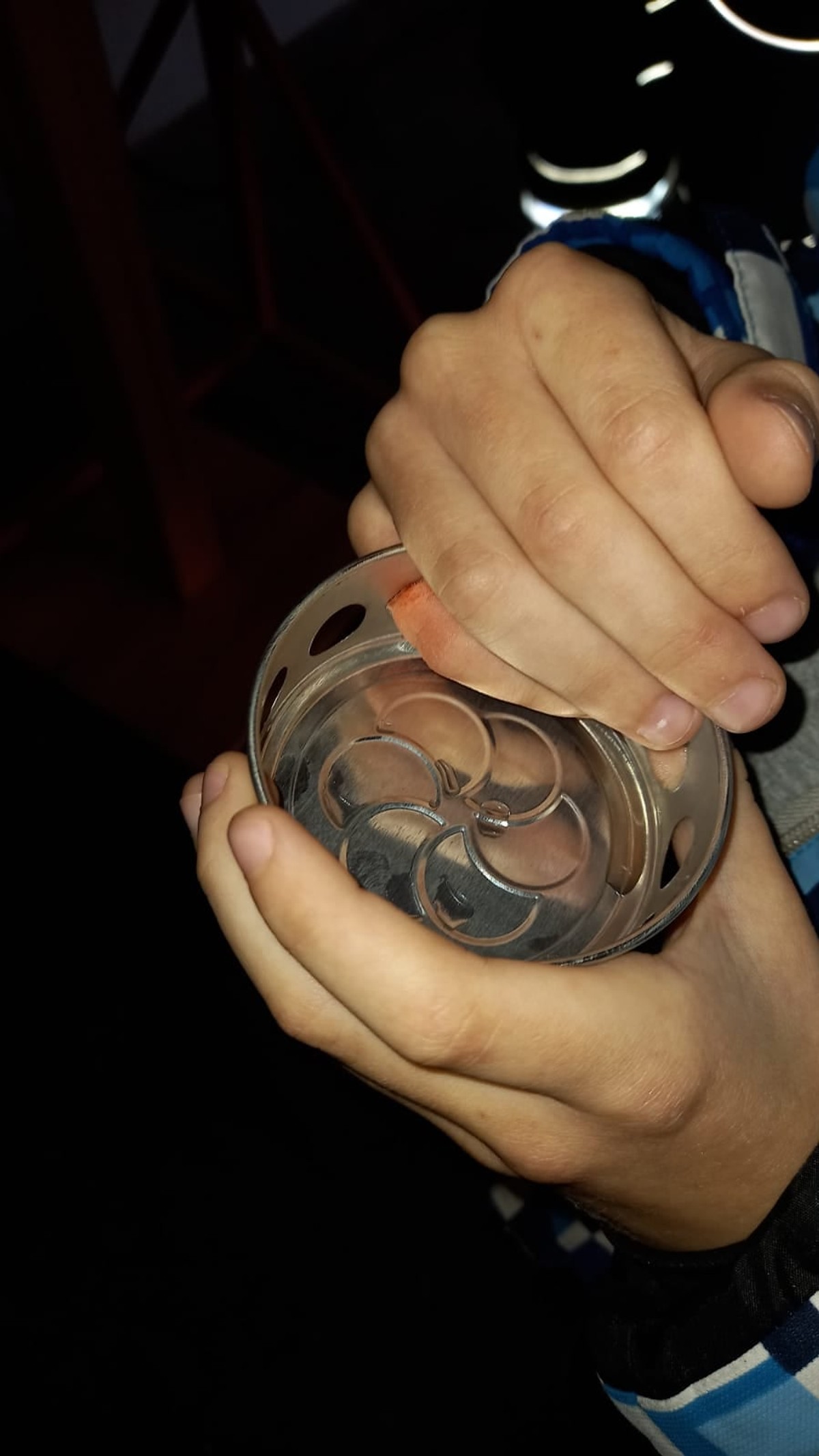 NEOBIČNA NEZGODA Vatrogasci 'spašavali' prst zagljavjen u poklopcu lumina