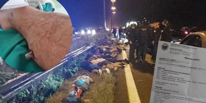 SRAMOTNA 'ISTRAGA' ZAGREBAČKE POLICIJE 'Propucali su mi nogu, a onda nasrnuli na navijače koji su mi spašavali život'