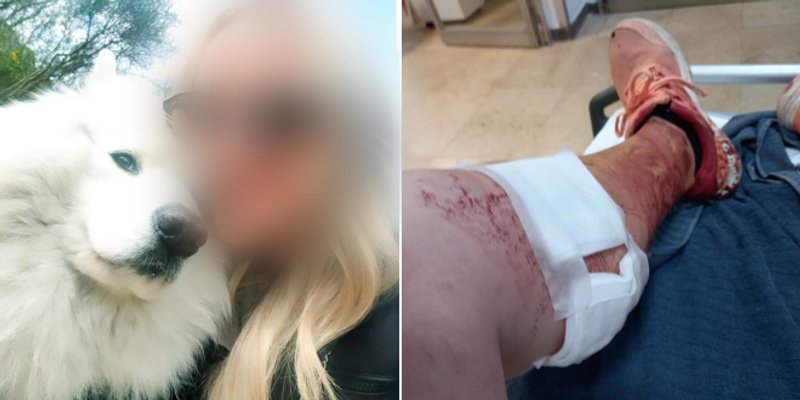 STRAVA U SRINJINAMA Vučjak nasrnuo na ženu i psa: 'Zgrabio je Messija pa napao mene'