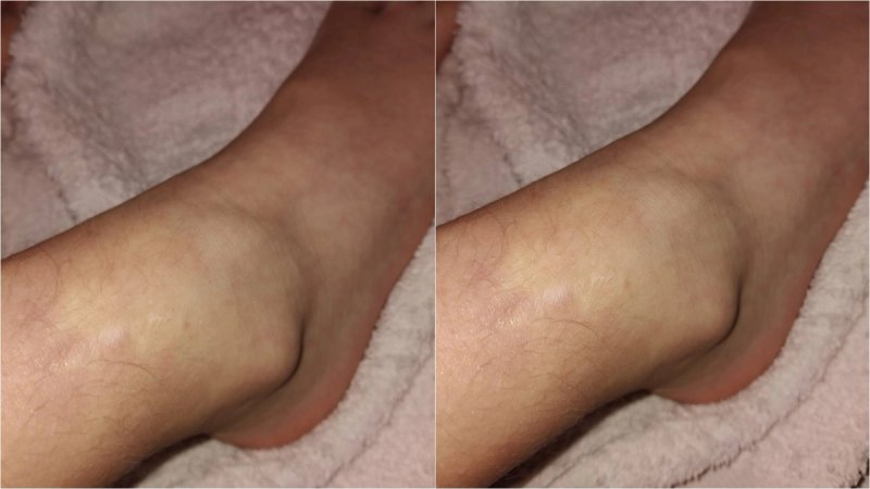 HUMANITARNA AKCIJA Prikuplja se pomoć za liječenje i smještaj djevojčice u Zagrebu