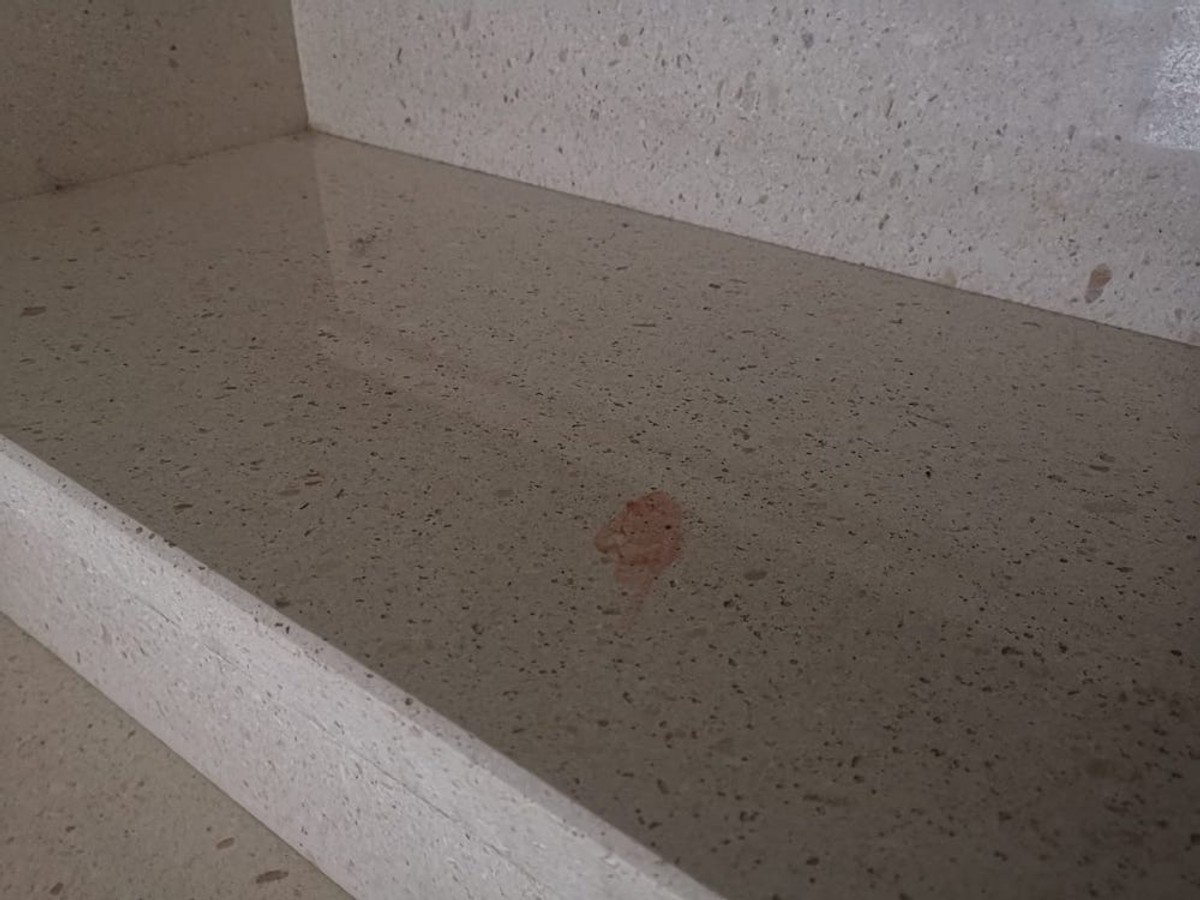 NAPAD U VAROŠU Šipkama izudarali muškarca na stubištu zgrade!