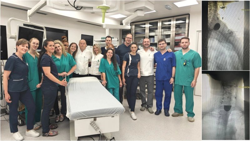 Zavod za gastroenterologiju KBC-a Split uveo novu metodu liječenja!