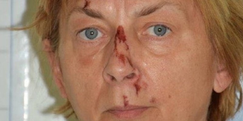 Otkriven identitet žene nađene na Krku!