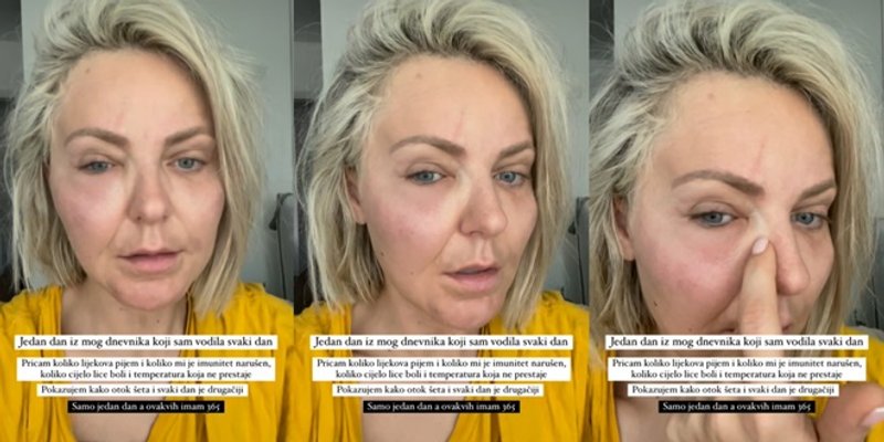 STANKICA OČAJNA Bivša partnerica splitskog Gospodina savršenog pati od autoimune bolesti