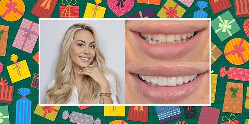 MJESEC DARIVANJA Dalmatinski portal & Salona Dental uljepšat će vam osmijeh