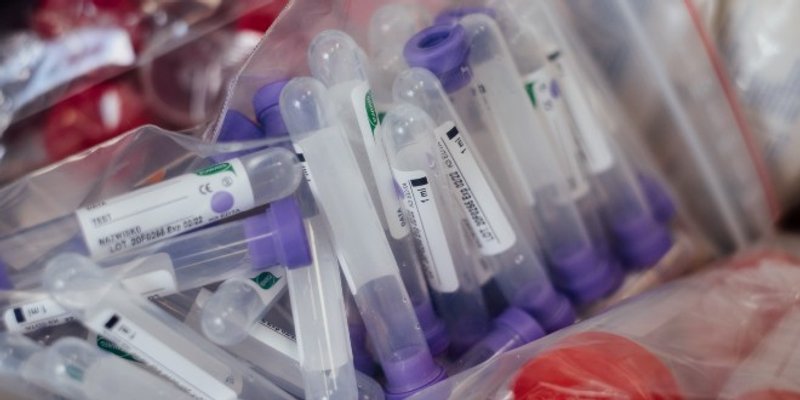 GRAD ZAGREB 31 novi slučaj zaraze koronom