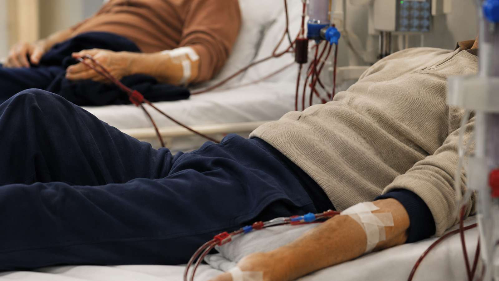 Pacijenti više ne moraju u bolnicu: KBC Split uveo kućnu hemodijalizu