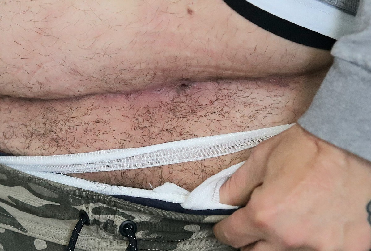 Marinko Pivčević i supruga ogorčeni postupanjem policije: 'Otvorena mi je rana, sada moram na novu operaciju kile, a to košta 28 tisuća kuna'