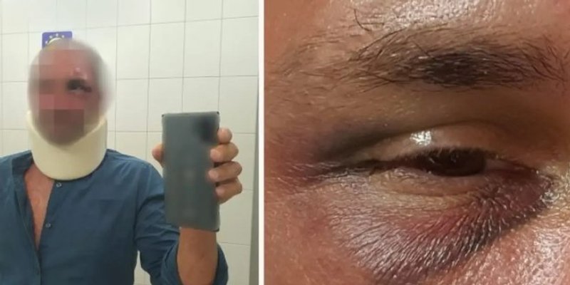 Beograđanina prebili na Korčuli 'Opsovao sam vozača kombija, mlatili su me gdje su stigli'