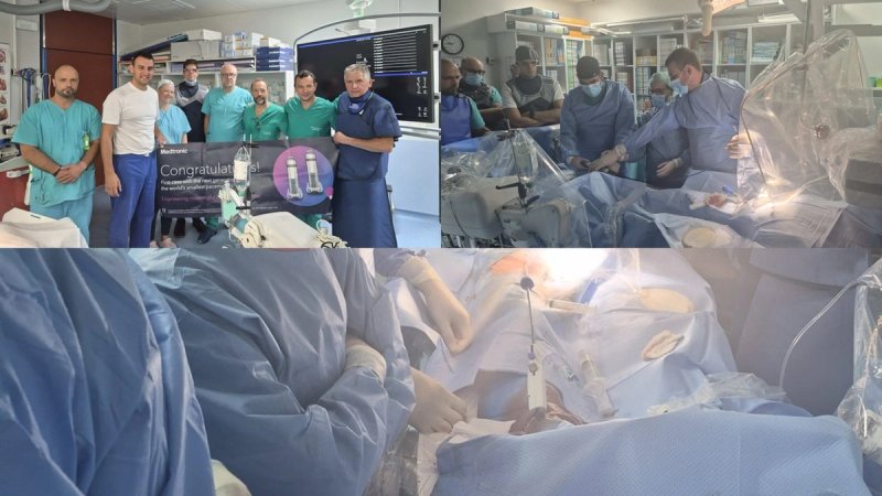 U OB Dubrovnik izvedena implantacija pacemakera najnovije generacije – Micra leadless