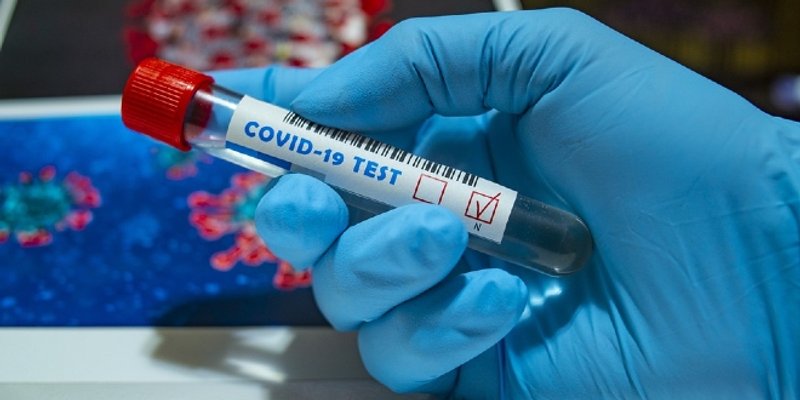 VIROLOGINJA Mutanti će nas pregaziti, virus je dobio raketni pogon