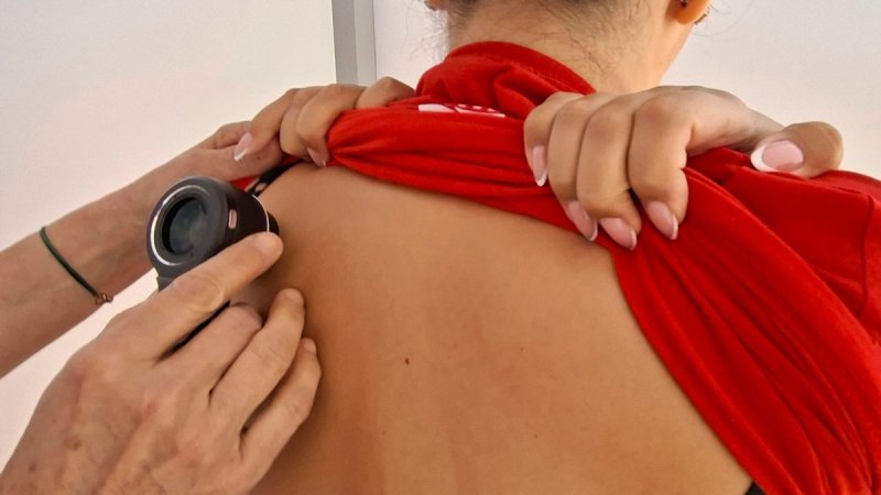 U nedjelju obavite besplatni dermatološki pregled u Vodicama