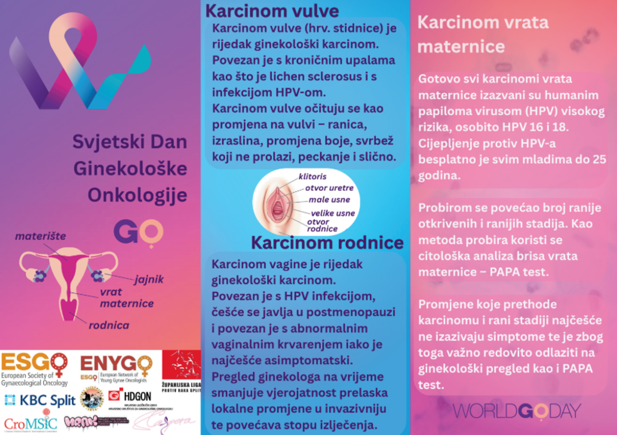 Pet karcinoma – pet liječnika – pet pacijentica: Svjetski dan ginekološke onkologije