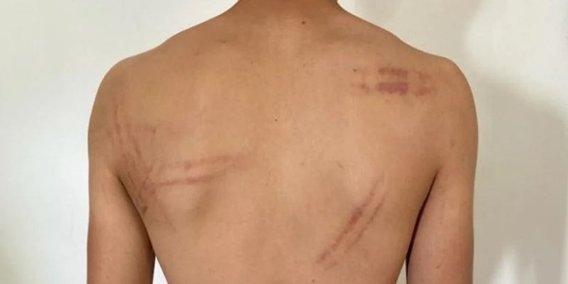 JAVIO SE OTAC PRETUČENOG MLADIĆA 'Namlatili ste čovjeka ni kriva ni dužna!'