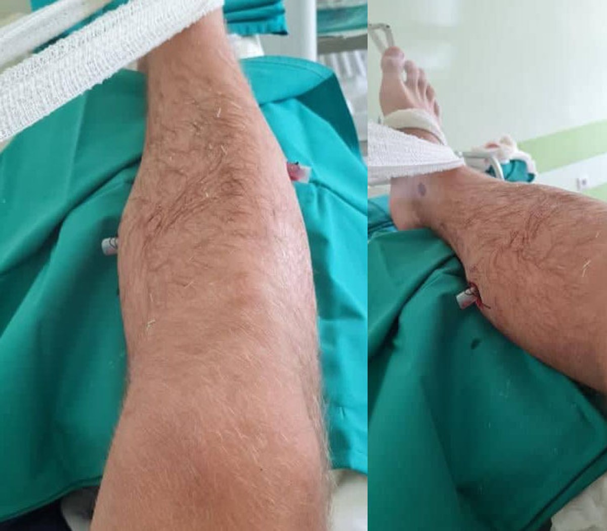 SRAMOTNA 'ISTRAGA' ZAGREBAČKE POLICIJE 'Propucali su mi nogu, a onda nasrnuli na navijače koji su mi spašavali život'