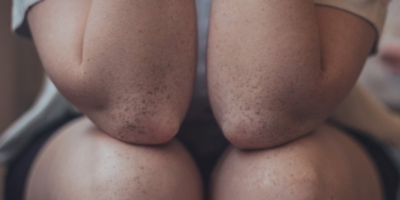 Što jesti za zdravlje zglobova? Ove namirnice čuvaju pokretljivost i smanjuju upale