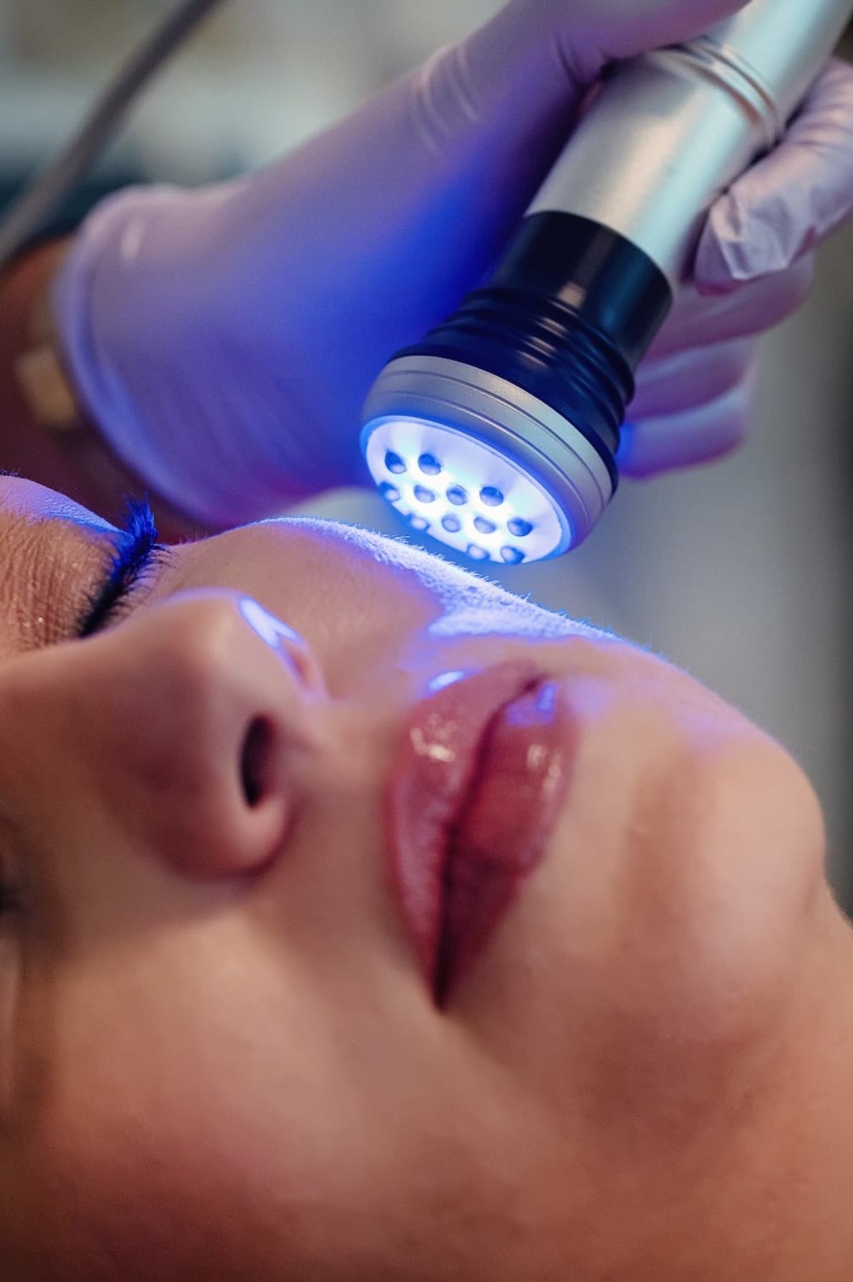 Fancy Imotski: Ukorak sa svjetskim trendovima u njezi lica