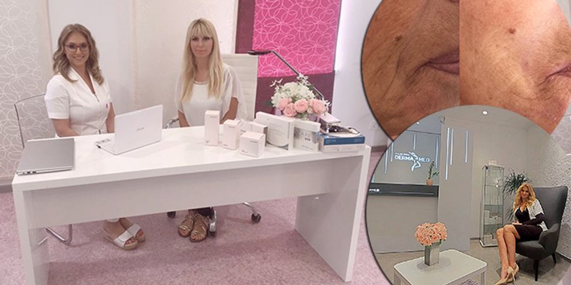 REGENERACIJA KOŽE NAKON ČETRDESETE Kako joj vratiti svježinu, volumen i fine linije?