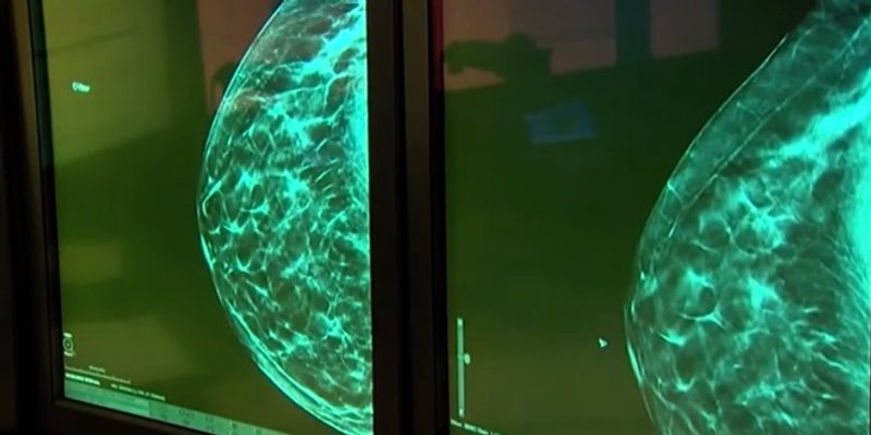 Europska komisija pojačanim mjerama obilježava pet godina Europskog plana za borbu protiv raka