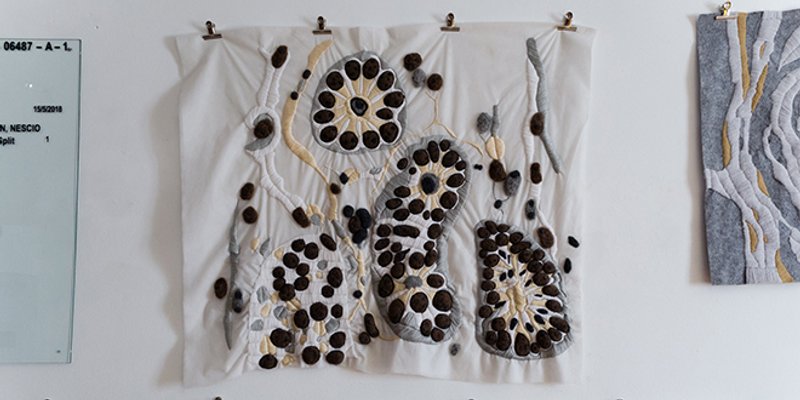 IZLOŽBA NIKOLINE KUZMIĆ 'Tapiserijama' prikazala šest malignih bolesti 