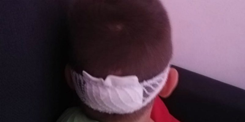 STRAŠNO Sedmogodišnji dječak upao u rupu na Pujankama