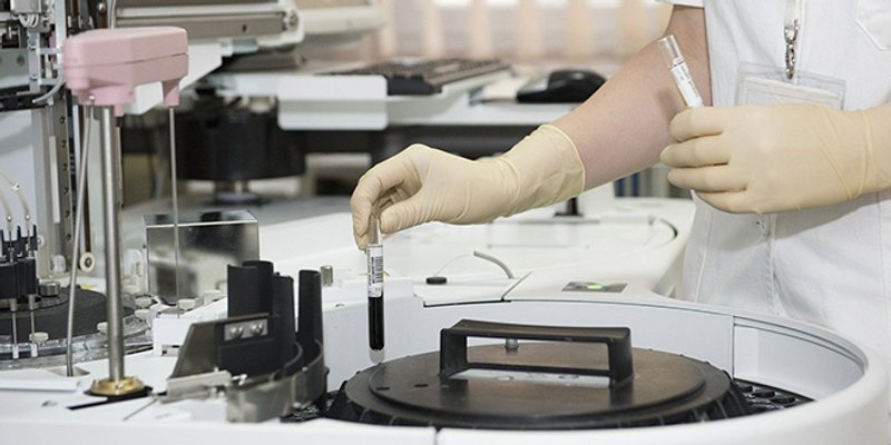 KORONA BROJKE Umrlo 14 osoba, danas u Hrvatskoj 322 nova slučaja