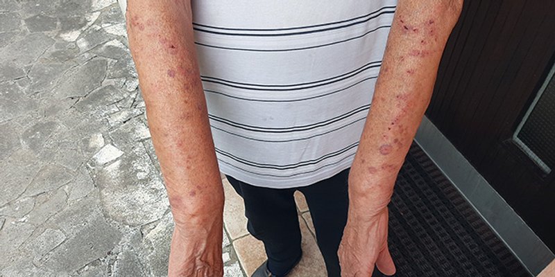 PRONAŠLI SMO ČOVJEKA 'Istina je, zaskočili su me migranti i uz prijetnju pištolja natjerali da ih satima vodim kroz šumu'