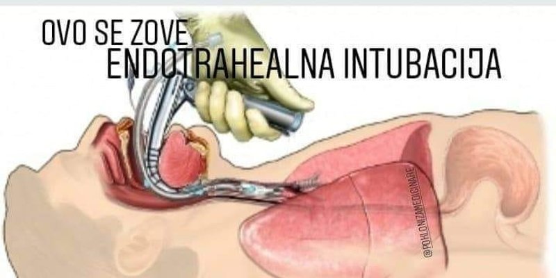 MEDICINSKE SESTRE I TEHNIČARI: Ovo se zove endotrahealna intubacija. Važno je da znate ukoliko vas maska previše žulja