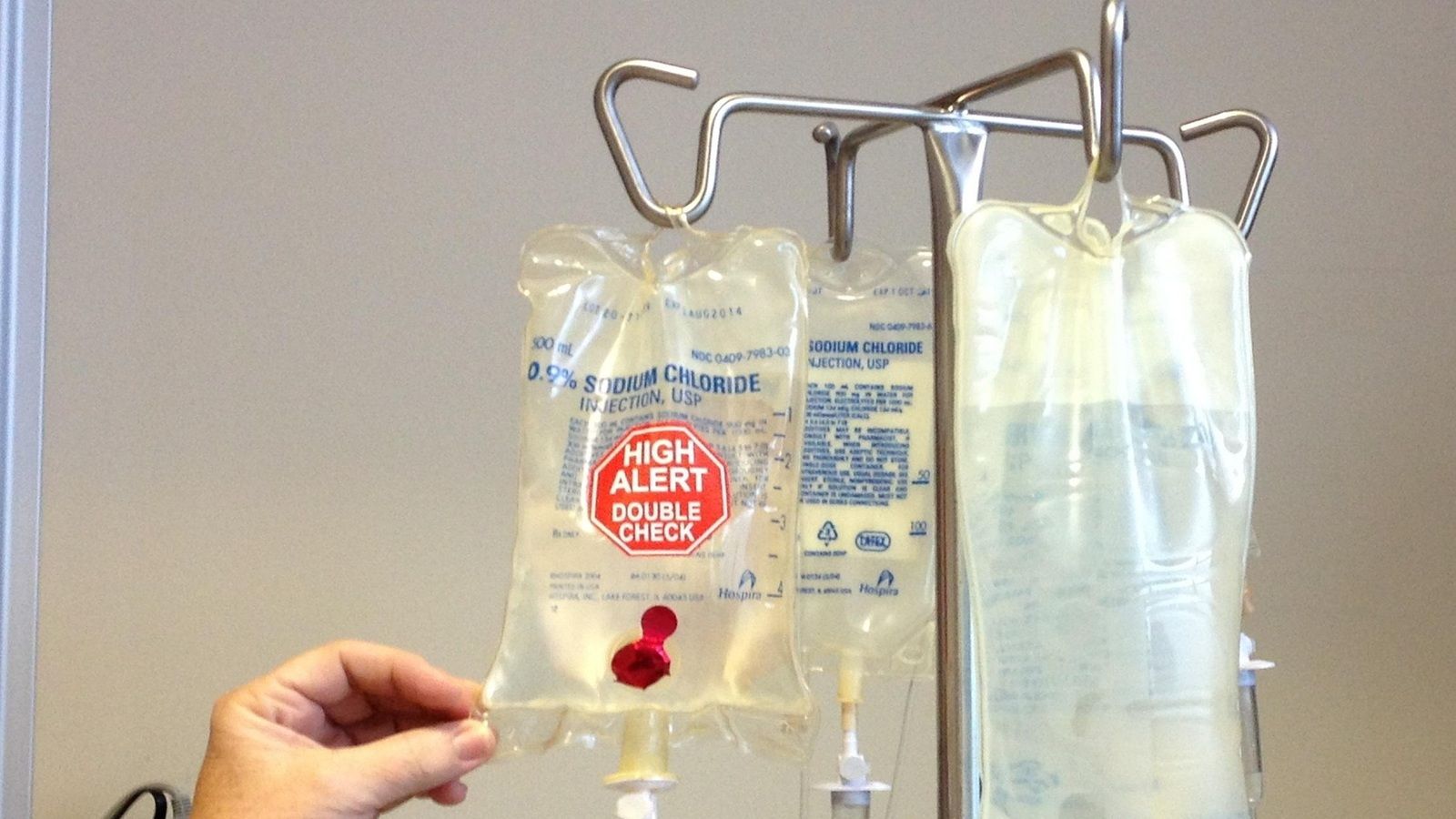 SKANDAL U ŠPANJOLSKOJ Treći pacijent umro nakon predoziranja kemoterapijom