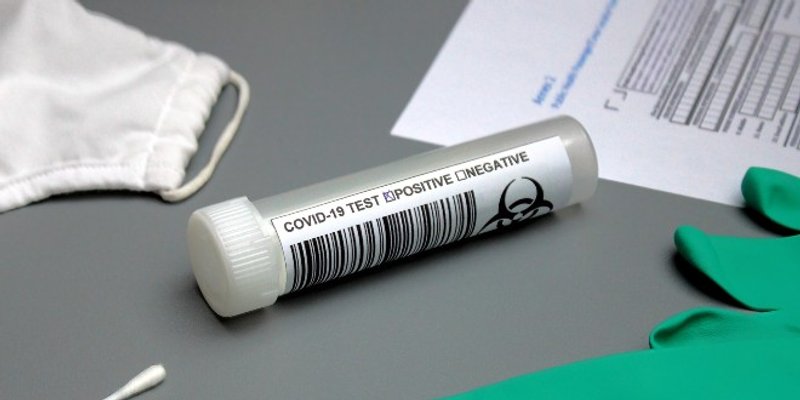 Španjolska uvodi lokalne karantene, a daleko nisu ni druge zemlje Europe: Svi se boje novog lockdowna...