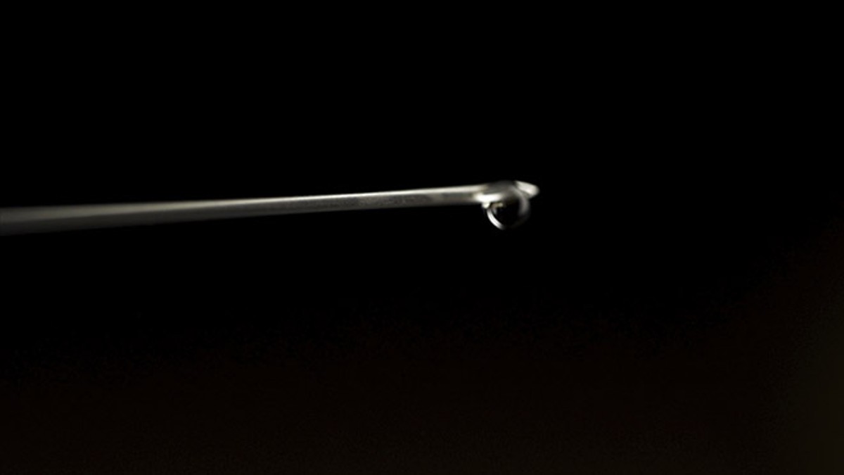 Priska Med Aesthetics traži modele: Prijavi se za besplatan estetski zahvat pod vodstvom vrhunskih liječnika!