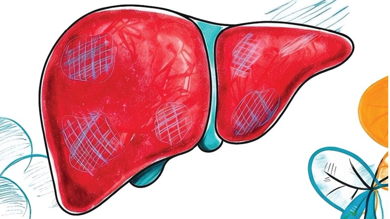 Besplatno, bez uputnice i bez naručivanja dođite na pretragu koja mjeri stupanj oštećenja jetre