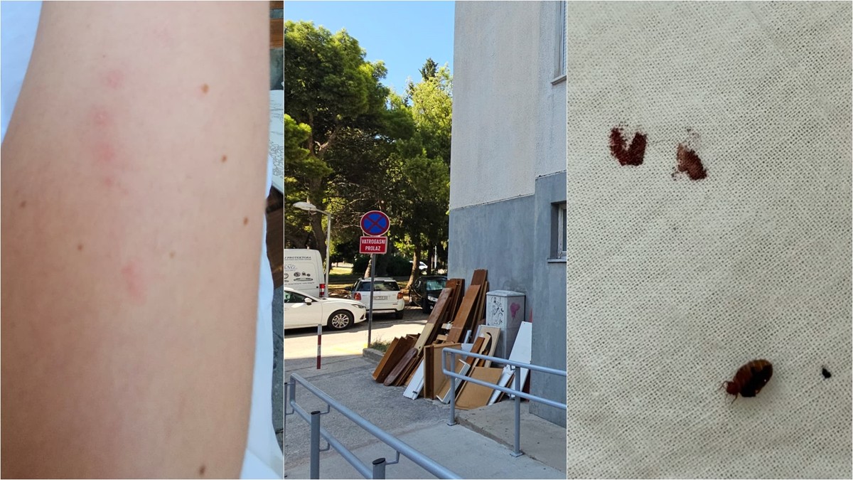 Stanari traže pomoć zbog najezde stjenica u splitskom kvartu: 'Puni smo ugriza'