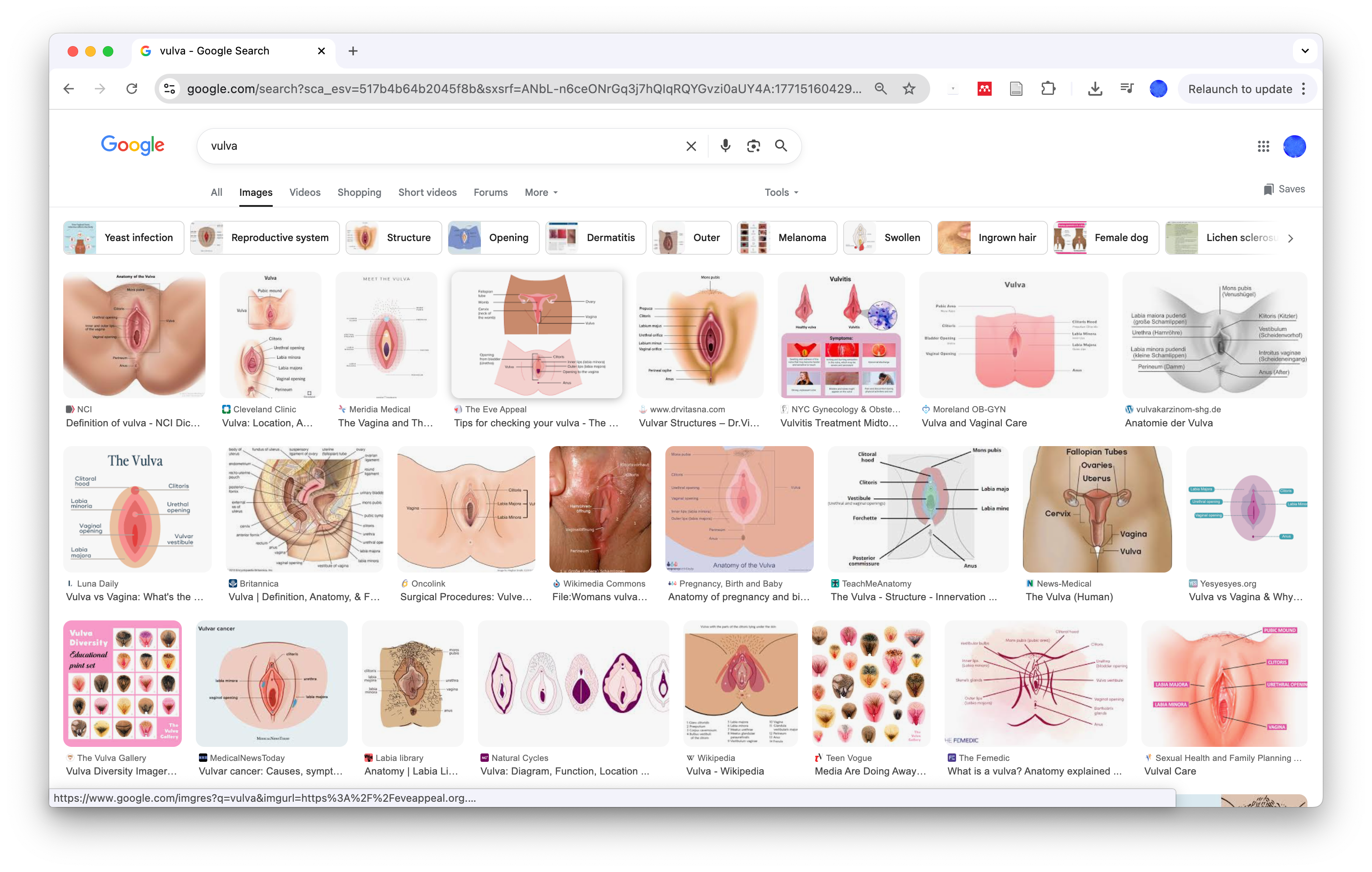Google Images results for "vulva", dominated by anatomical diagrams and labelled illustrations.
