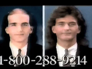 Before+And+After+Vintage+GIF.gif Animated reaction: Before And After Vintage