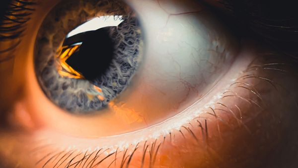 LASIK Eye Surgery Recovery Tips and Healing Timeline